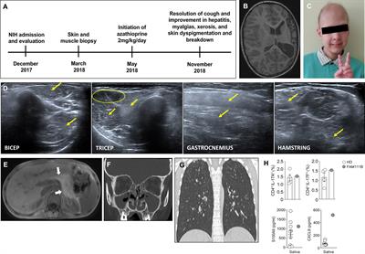 Frontiers Case Report Discovery Of A De Novo FAM111B Pathogenic